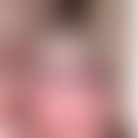 Candida-Balanitis bei bekanntem Diabetes mellitus
