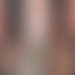 CTLA-4-Haploinsuffizienz: schwere atopische Dermatitis mit Befall der Extremitäten (Abb. entnomme...