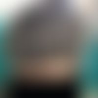 Griscelli-Syndrom Typ 3: silbergraues Haar bei einem indischen Patienten.&nbsp;
