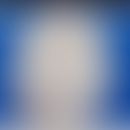 Albinismus okulokutaner:&nbsp;silberweißes Haar bei Okulokutanem Albinimus Typ 1 (OCA1). Abb. ent...