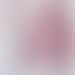 Zoster (Herpes zoster): frische Infektion mit segementalem Befallsmuster. Gruppierte und konfluie...