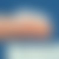 Fingertip-unit (Abb. entnommen aus: https://www.informedhealth.org/using-steroids-correctly-and-a...