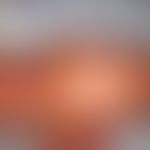 Autosomal Recessive kongenitale Ichthyose, Mutation in CYP4F22: Kollodiumbaby. Abb. entnommen aus...