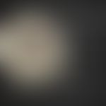 3D-Moulage "Superfiziell spreitendes Malignes Melanom".&nbsp;Moulage von R. Willi aus dem Moulage...