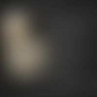 3D-Moulage "Ichthyosis Congenita"

Klicken Sie hier, um zur 3D-Moulage zu gelangen

Moulage von R...