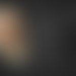 3D-Moulage "Fingerknöchel-Polster".&nbsp;Moulage von R. Willi aus dem Moulagenmuseum der Universi...
