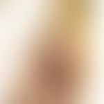 Trichophyton erinacei: pustulöse Tinea manis. Abb entnommen aus: Choi E et al. (2018) &nbsp;

