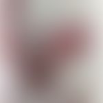 IgA-Pemphigus:&nbsp;flächige, teils&nbsp;reepithelisierte schmerzhafte Erosionen S.unter Fallberi...