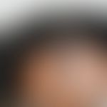 Spitzer Haaransatz mit auslaufender Behaarung der Stirnmitte:&nbsp; Abb. entnommen aus: https://w...