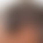 Spitzer Haaransatz: Abb. entnommen aus:&nbsp;Abb. entnommen aus: https://open.spotify.com/intl-de...