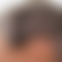 Spitzer Haaransatz: Abb. entnommen aus:&nbsp;Abb. entnommen aus: https://open.spotify.com/intl-de...