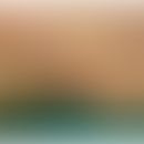 CALME (Childhood Asymmetry Labium Majus Enlargement): Einseitige Weichsteilschwellung der Vulva
