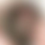 Perifolliculitis capitis abscedens et suffodiens :&nbsp;&nbsp;40J. Zunächst rapide aufgetreten kl...