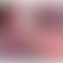 Mukokutanes Ulkus, EBV-induziertes: torpide Ulzera vor und nach Therapie. Abb.entnommen aus&nbsp;...