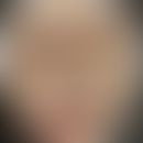 Syphilis maligna: Historische Moulage. Abbildung entnommen aus: K. Zieler, Atlas der Haut- und Ge...