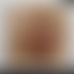 Herpes simplex genitalis: Historische Moulage. Abbildung entnommen aus: K. Zieler, Atlas der Haut...